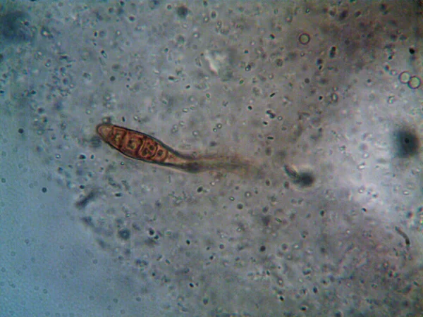 顕微鏡で見た微生物X100 — ストック写真