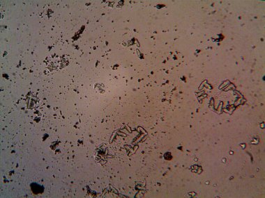 Çıkarılmış kristaller, ev yapımı fotoğraf.