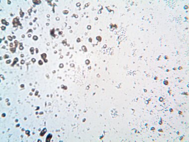 Çıkarılmış kristaller, ev yapımı fotoğraf.