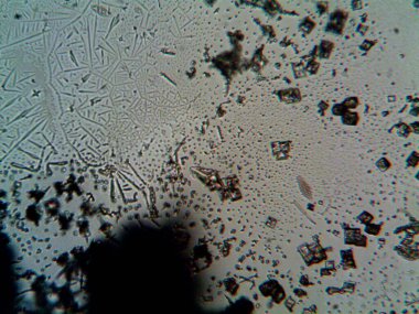 Çıkarılmış kristaller, ev yapımı fotoğraf.