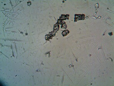 Çıkarılmış kristaller, ev yapımı fotoğraf.