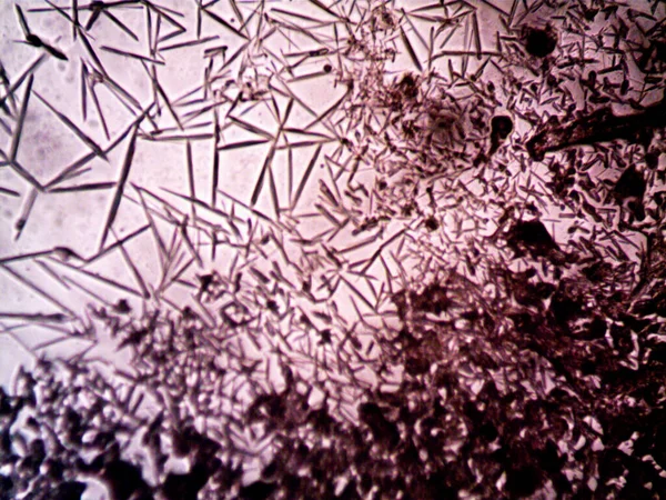 Мікроскоп Лавк Фото Саморобних Кристалів — стокове фото