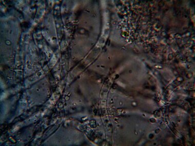 mikroorganizma, küçük yaprak kalıbında.