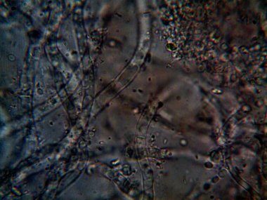 mikroorganizma, küçük yaprak kalıbında.