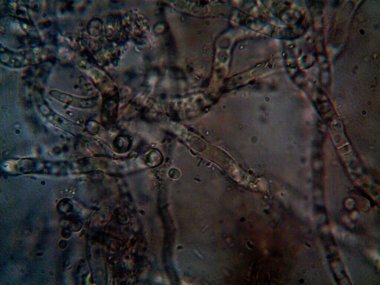 mikroorganizma, küçük yaprak kalıbında.