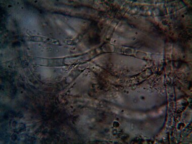 mikroorganizma, küçük yaprak kalıbında.