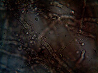 mikroorganizma, küçük yaprak kalıbında.