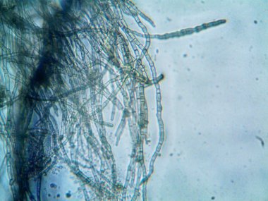 mikroorganizma, küçük yaprak kalıbında.