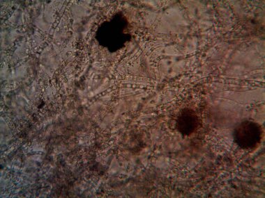 mikroorganizma, küçük yaprak kalıbında.