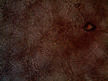 mikroorganizma, küçük yaprak kalıbında.