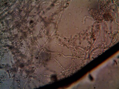 mikroorganizma, küçük yaprak kalıbında.