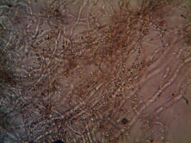 mikroorganizma, küçük yaprak kalıbında.