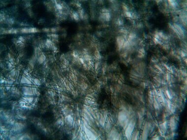 mikroorganizma, küçük yaprak kalıbında.