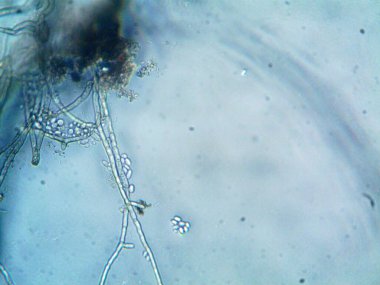 mikroorganizma, küçük yaprak kalıbında.