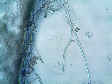 mikroorganizma, küçük yaprak kalıbında.