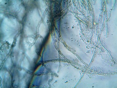 mikroorganizma, küçük yaprak kalıbında.