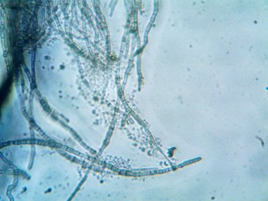 mikroorganizma, küçük yaprak kalıbında.