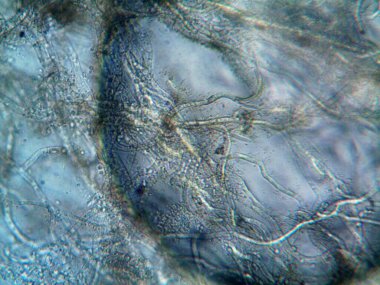 mikroorganizma, küçük yaprak kalıbında.