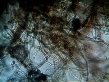 mikroorganizma, küçük yaprak kalıbında.