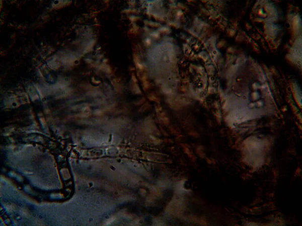 Microorganismo Pequeño Molde Hojas — Foto de Stock