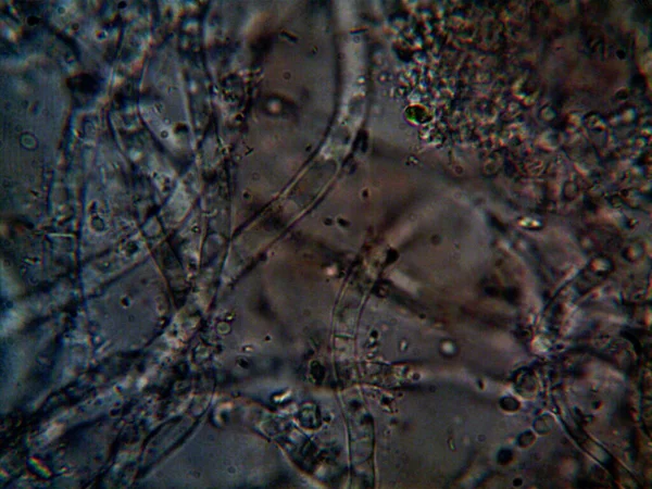 Mikroorganizm Drobnolistnej Pleśni — Zdjęcie stockowe