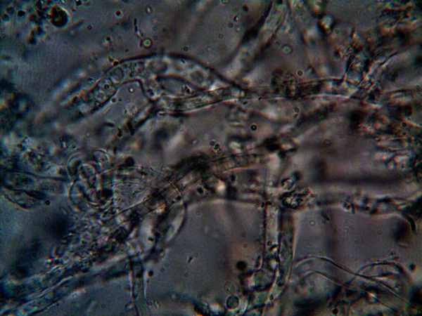 Micro Organisme Kleine Bladvorm — Stockfoto