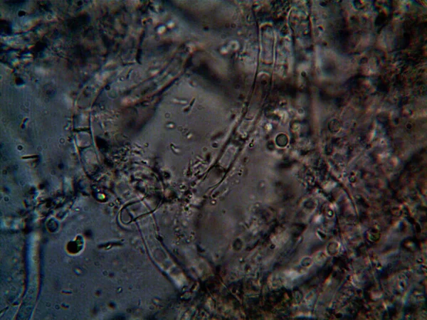 Microorganismo Pequeño Molde Hojas —  Fotos de Stock