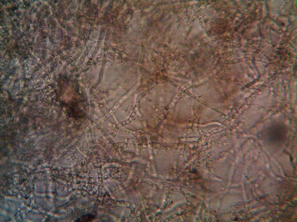 Mikroorganismus Malé Listové Plísni — Stock fotografie