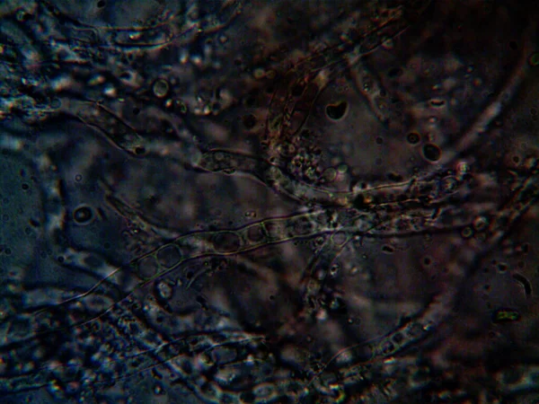 Mikroorganizm Drobnolistnej Pleśni — Zdjęcie stockowe