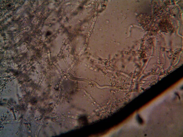 mikroorganizma, küçük yaprak kalıbında.