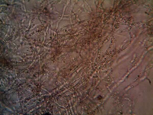 mikroorganizma, küçük yaprak kalıbında.