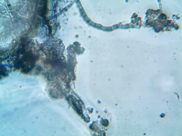 Mikroorganizmus Kis Levelű Penészgombán — Stock Fotó