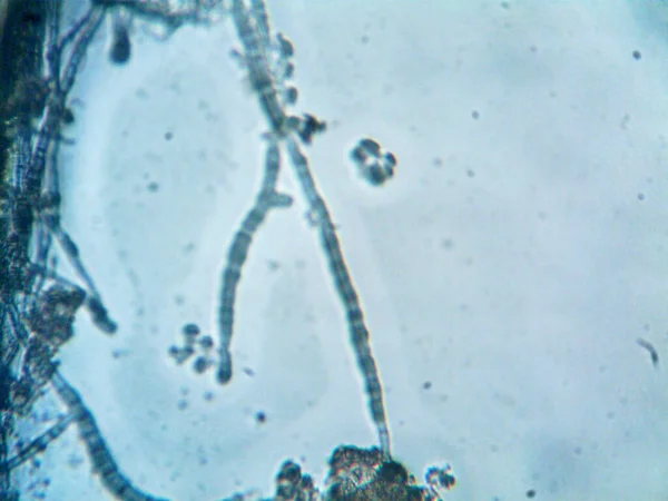 Мікроорганізм Дрібній Листяно Якій — стокове фото