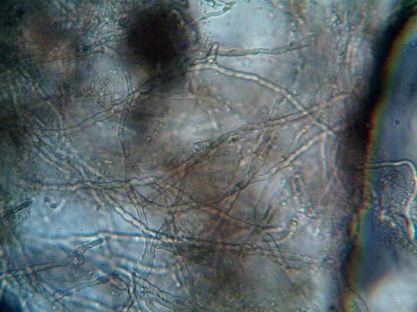 Микроорганизм Мелкой Листовой Плесени — стоковое фото