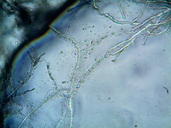 Mikroorganizma Küçük Yaprak Kalıbında — Stok fotoğraf