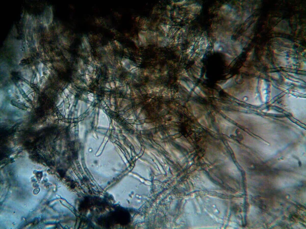 mikroorganizma, küçük yaprak kalıbında.