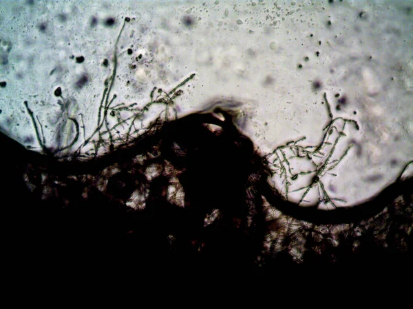 Microrganismo Pequenos Moldes Foliares — Fotografia de Stock