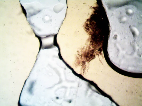顕微鏡で作られた大麻のThcのCbd写真 — ストック写真