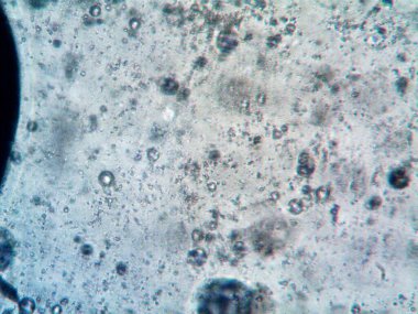 Mikroskop tarafından yapılmış kenevir thc cbd fotoğrafı