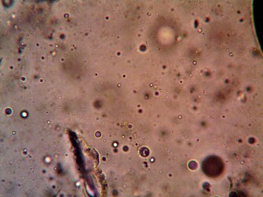 Mikroskop tarafından yapılmış kenevir thc cbd fotoğrafı