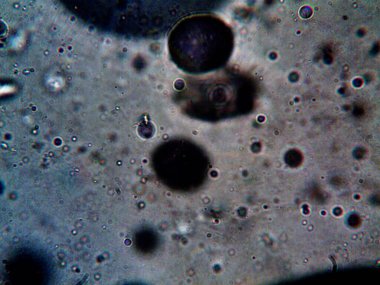 Mikroskop tarafından yapılmış kenevir thc cbd fotoğrafı