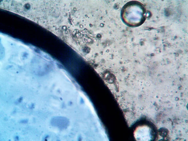 Cannabis Thc Cbd Photo Faite Par Microscope — Photo