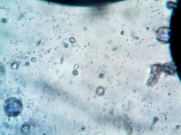顕微鏡で作られた大麻のThcのCbd写真 — ストック写真