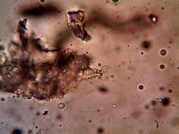 Cannabis Thc Cbd Foto Gjort Mikroskop — Stockfoto