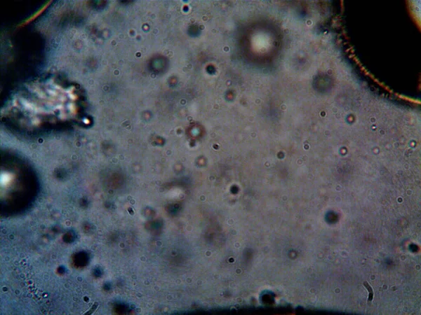 Cannabis Thc Cbd Foto Med Mikroskop – stockfoto