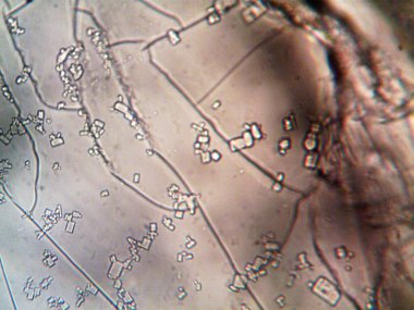 Mikroskop lavenhuk, ev yapımı kristallerin fotoğrafı.