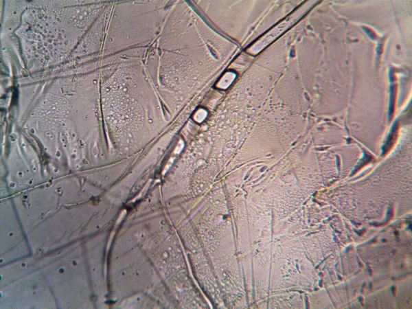 Microsscope Lavenhuk Фото Самодельных Кристаллов — стоковое фото