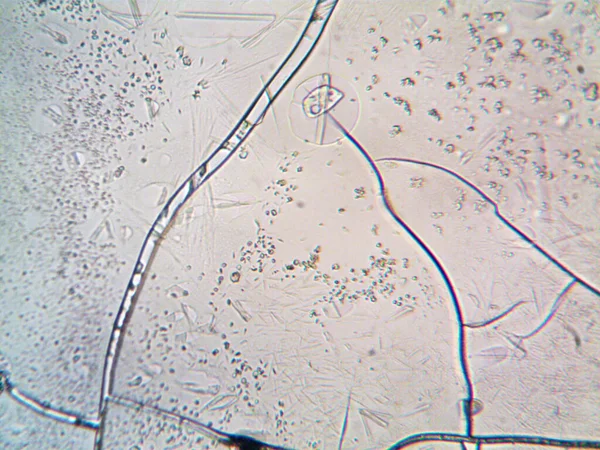 Microscoop Lavenhuk Foto Van Zelfgemaakte Kristallen — Stockfoto