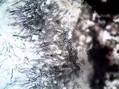 mikroorganizma fotoğrafı mikroskopla yapıldı.