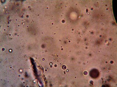 mikroorganizma fotoğrafı mikroskopla yapıldı.